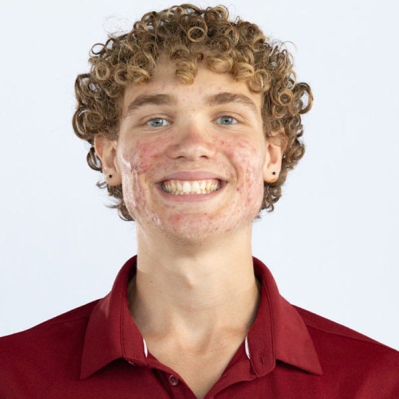 Andrew Catapano